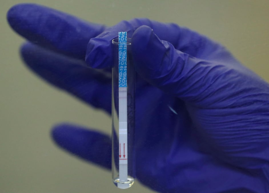 Coronavirus: validation en vue en france de tests mesurant l'immunisation