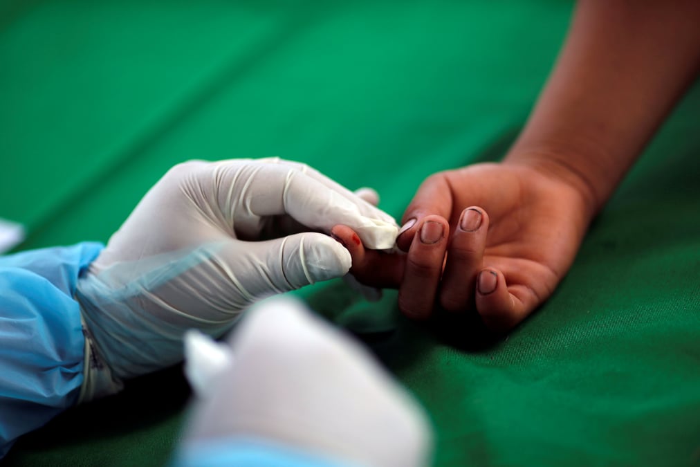 Coronavirus: le nombre de deces au bresil depasse les 60.000