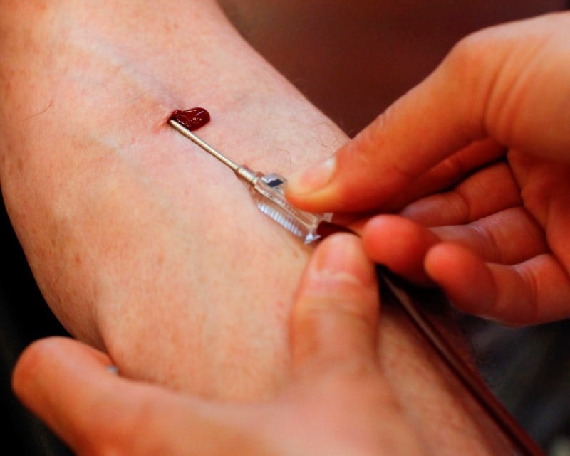 La cjue estime que l'exclusion des homosexuels du don du sang doit etre strictement encadree