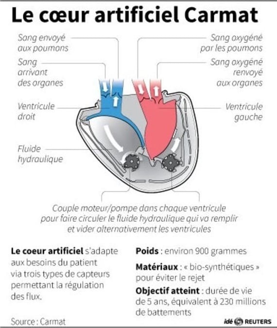 Le coeur artificiel carmat