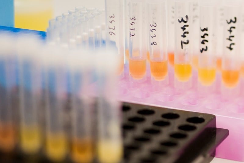 Le cio ordonne de nouveaux tests antidopages pour 31 athletes