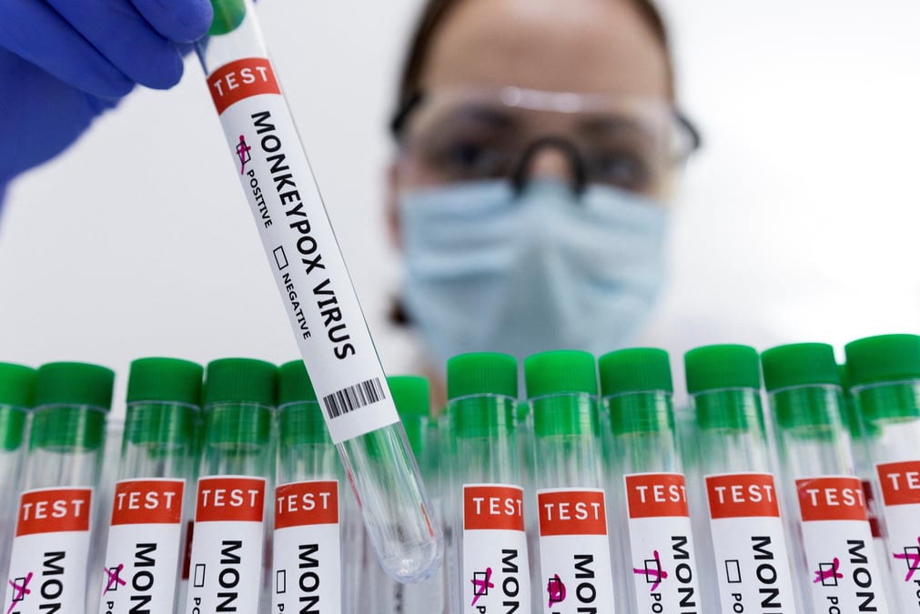 Variole du singe: trois cas confirmes en france, indique spf