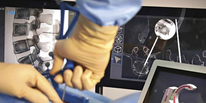 Surgivisio Ecential Robotics