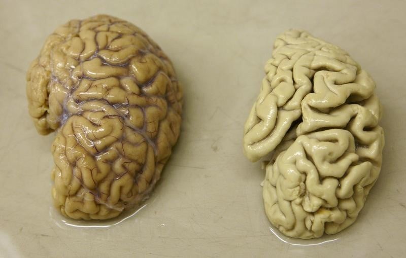 Revers pour le traitement experimental de la maladie d'alzheimer