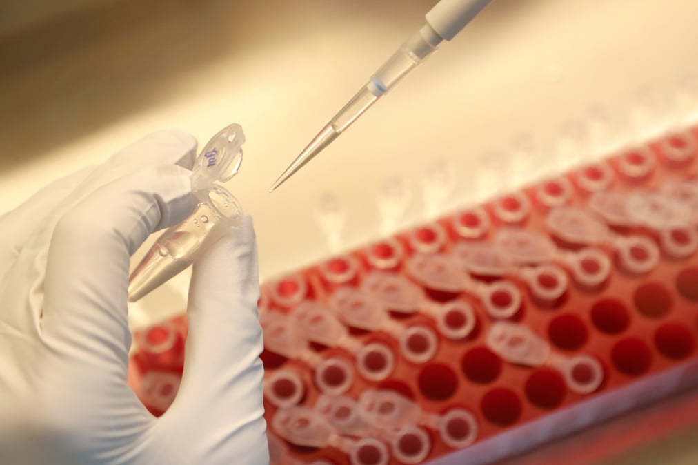 Pas de vaccination generalisee contre le coronavirus avant mi-2021, selon l'oms
