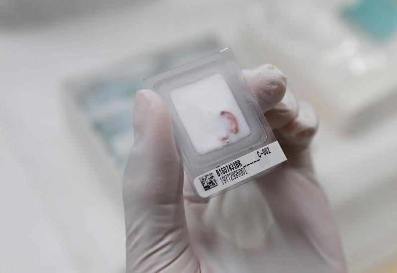Cellectis suspend des etudes cliniques apres un deces