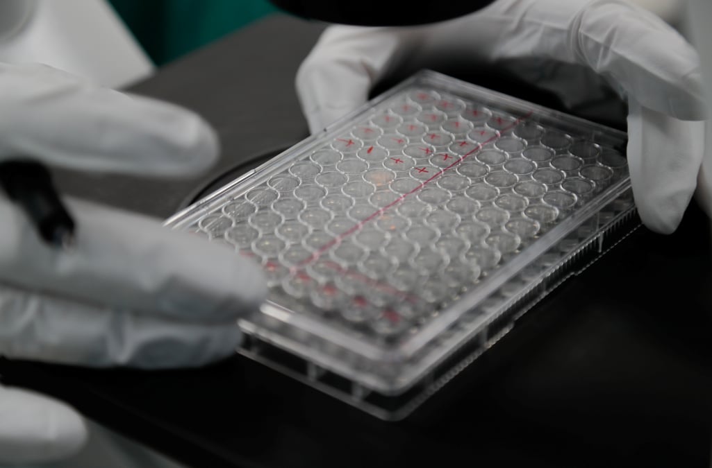 Coronavirus: le bilan depasse les 3.000 morts en russie