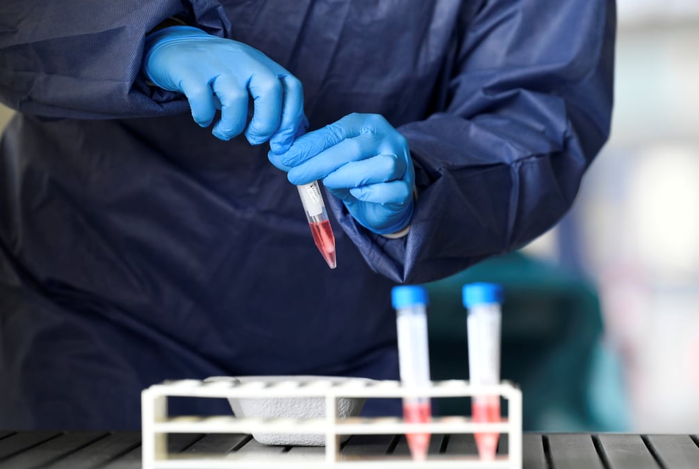 Coronavirus: plus de 1.200 morts et 21.000 cas aux pays-bas