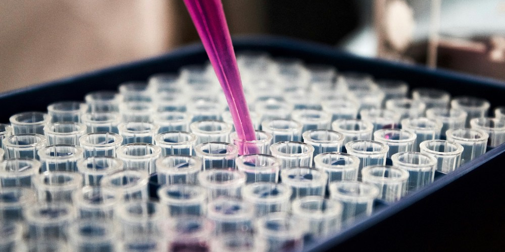 Le royalty financing est particulièrement répandu aux États-Unis dans le secteur des biotech.