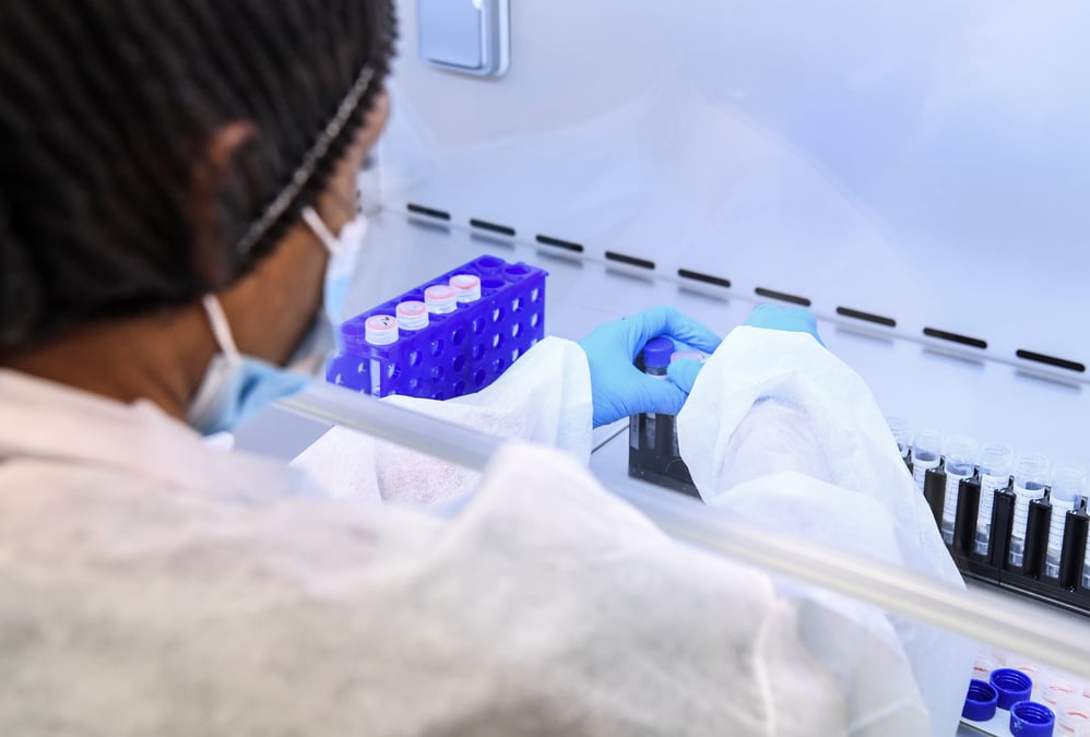 Coronavirus: 93 nouveaux deces dans les hopitaux francais, 28.432 morts au total