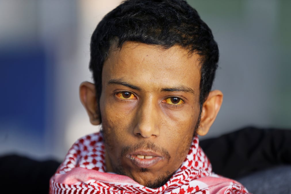 Yemen: echange de prisonniers entre ryad et les houthis