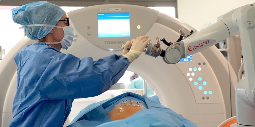 Le robot médical Epione, développé par Quantum Surgical à Montpellier, est destiné au traitement curatif et précoce des cancers, précisément pour des tumeurs inopérables dans l'abdomen et les poumons.