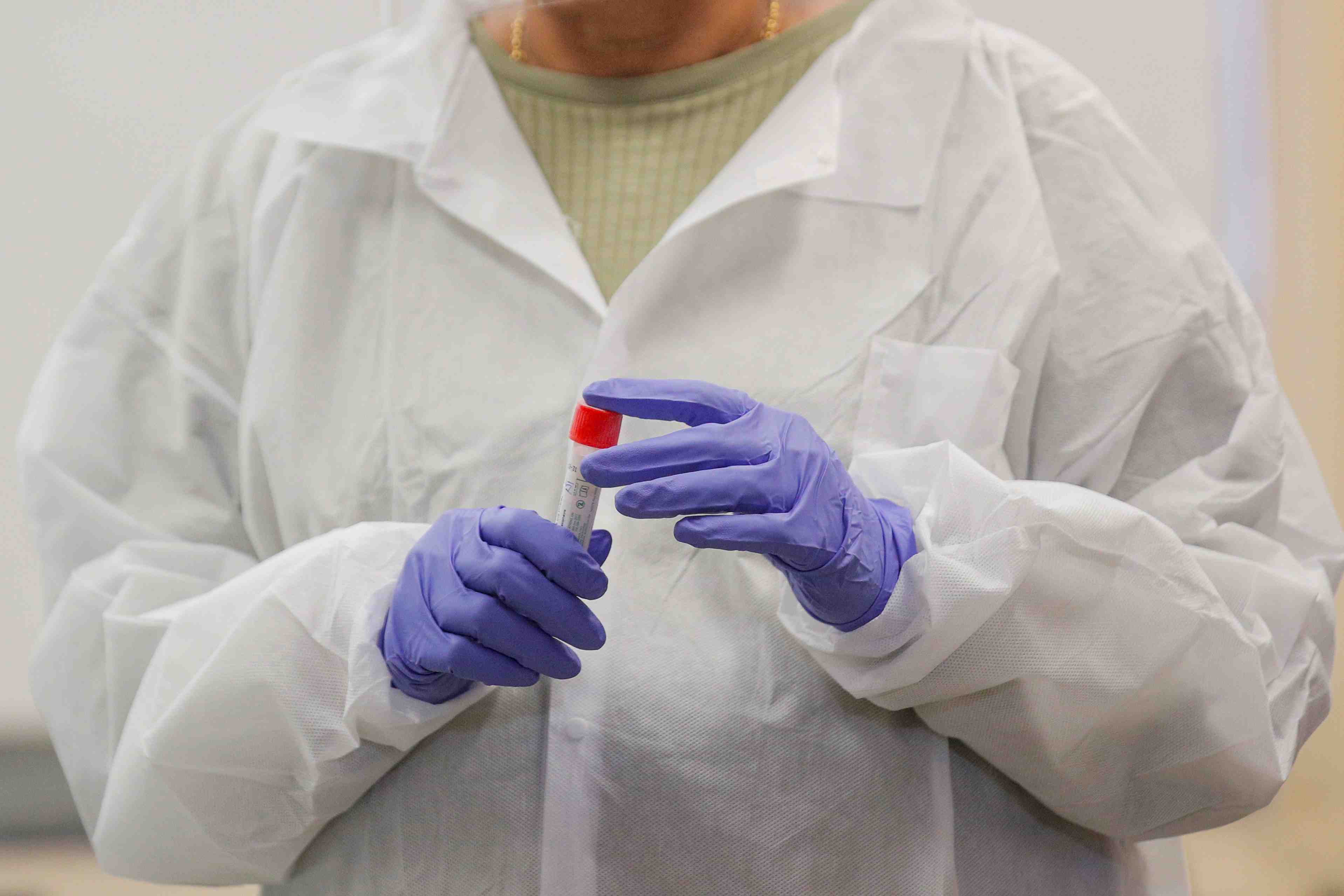 Coronavirus: biomerieux espere lancer prochainement deux tests serologiques