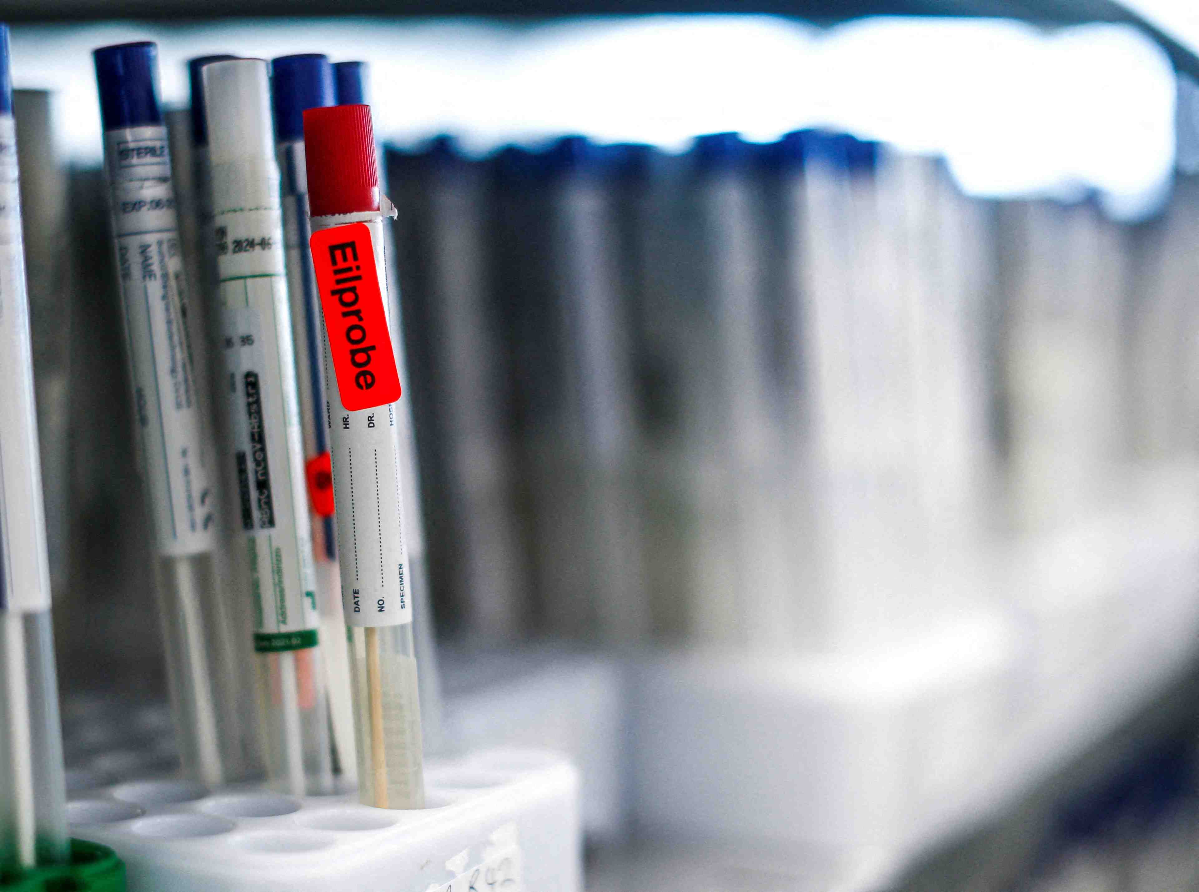 Coronavirus: nouveau record de cas en allemagne, les laboratoires craignent une penurie de tests