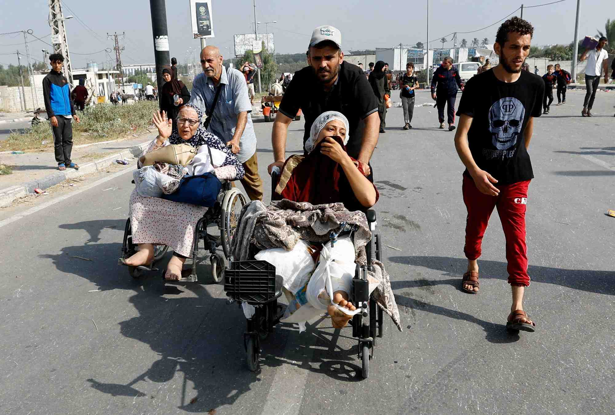 Une patiente de l'hopital al chifa evacuee du nord de gaza