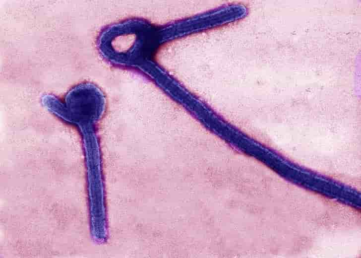 Le Mali confirme un deuxième cas de fièvre Ebola