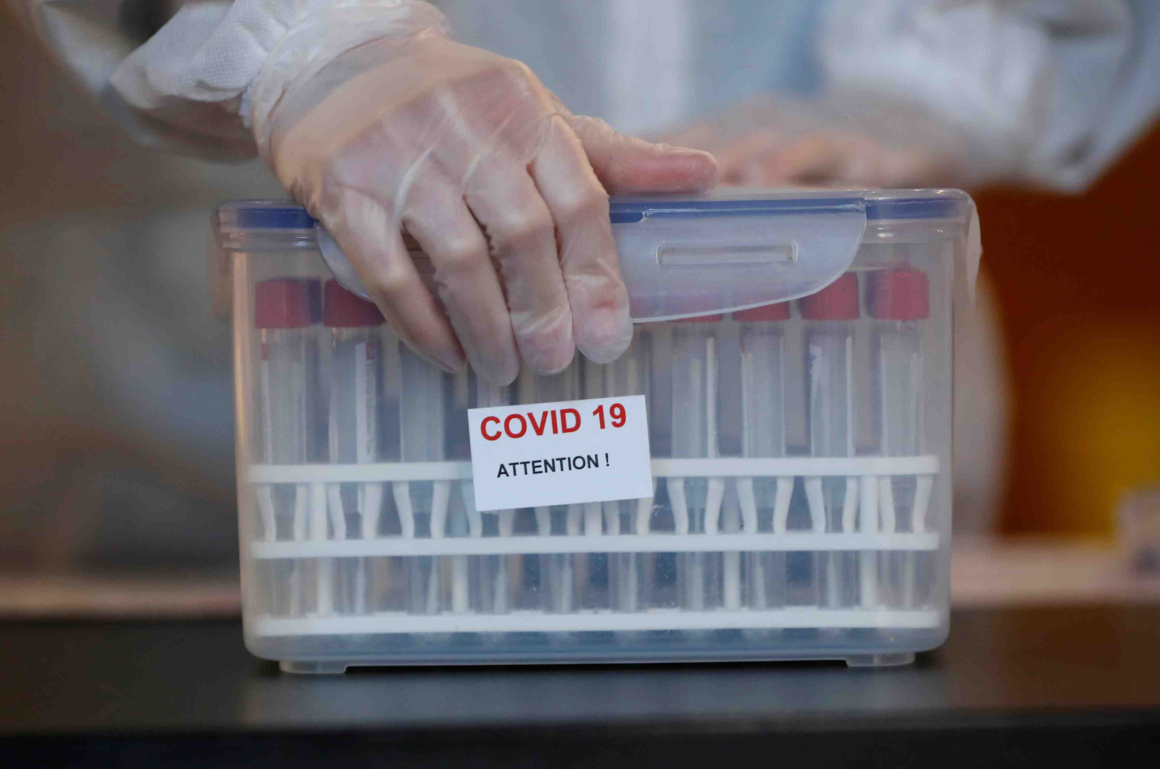 Coronavirus: plus de 25.000 nouveaux cas et pres de 300 morts supplementaires en france