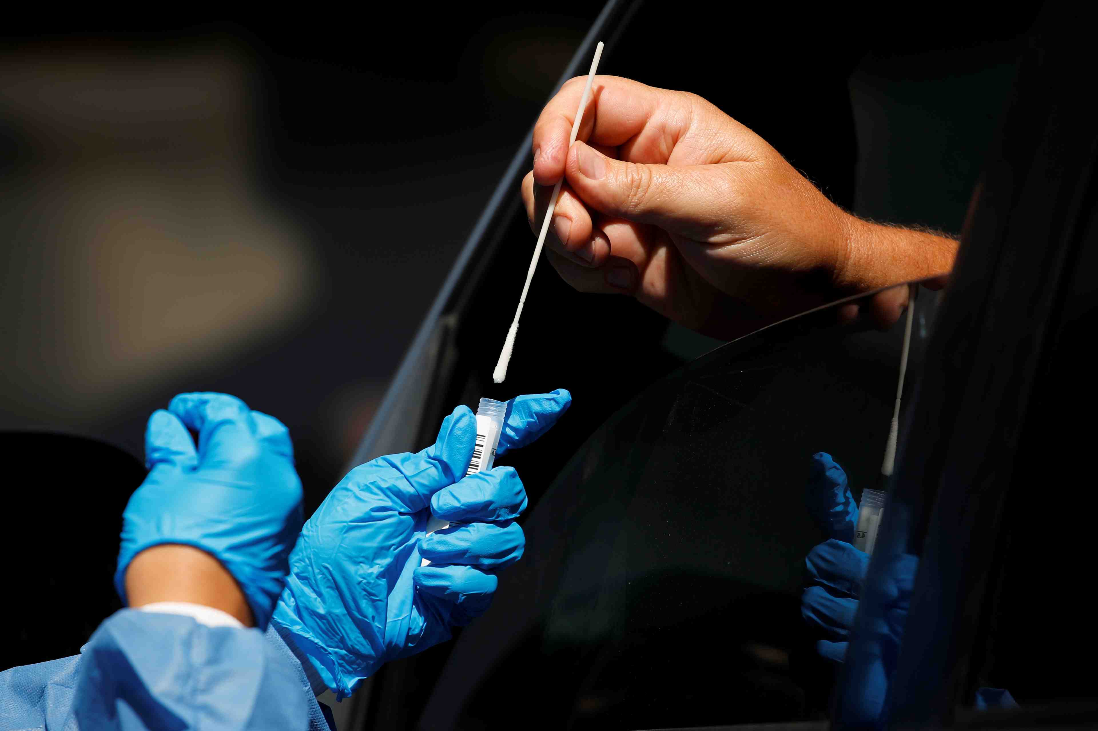 Coronavirus/usa: un test pas necessaire sans symptomes, selon les cdc
