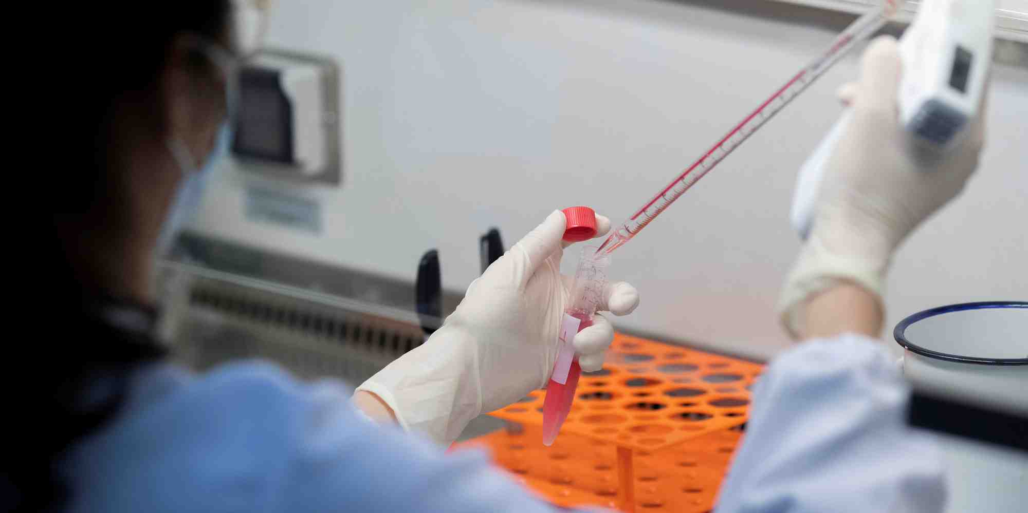 Photo d'illustration. Signe de l'intérêt global pour les vaccins tant d'un point de vue sanitaire qu'économique, le nombre de projets de vaccins ne cesse de gonfler.