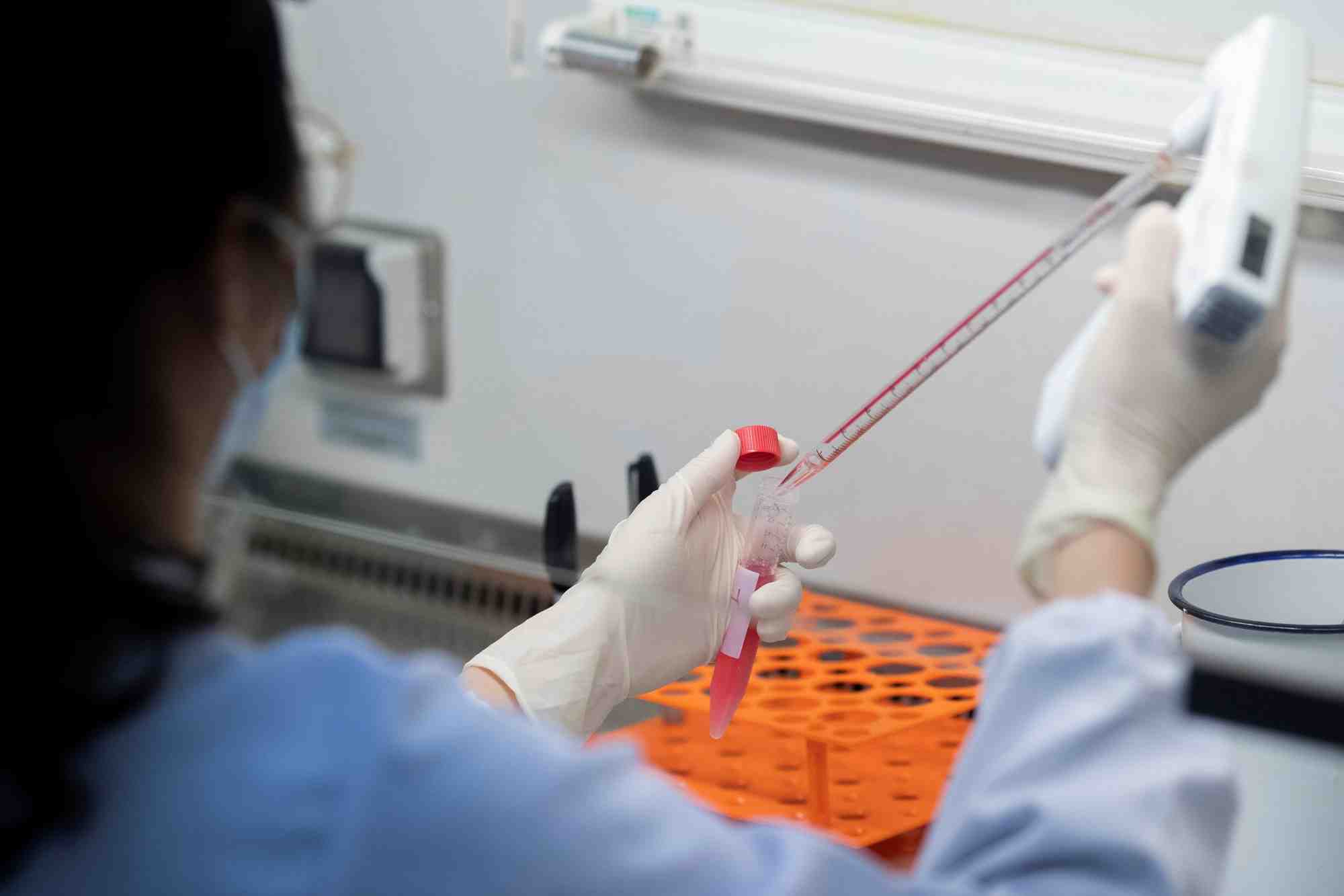 Coronavirus: des chercheurs chinois ont identifie des anticorps prometteurs