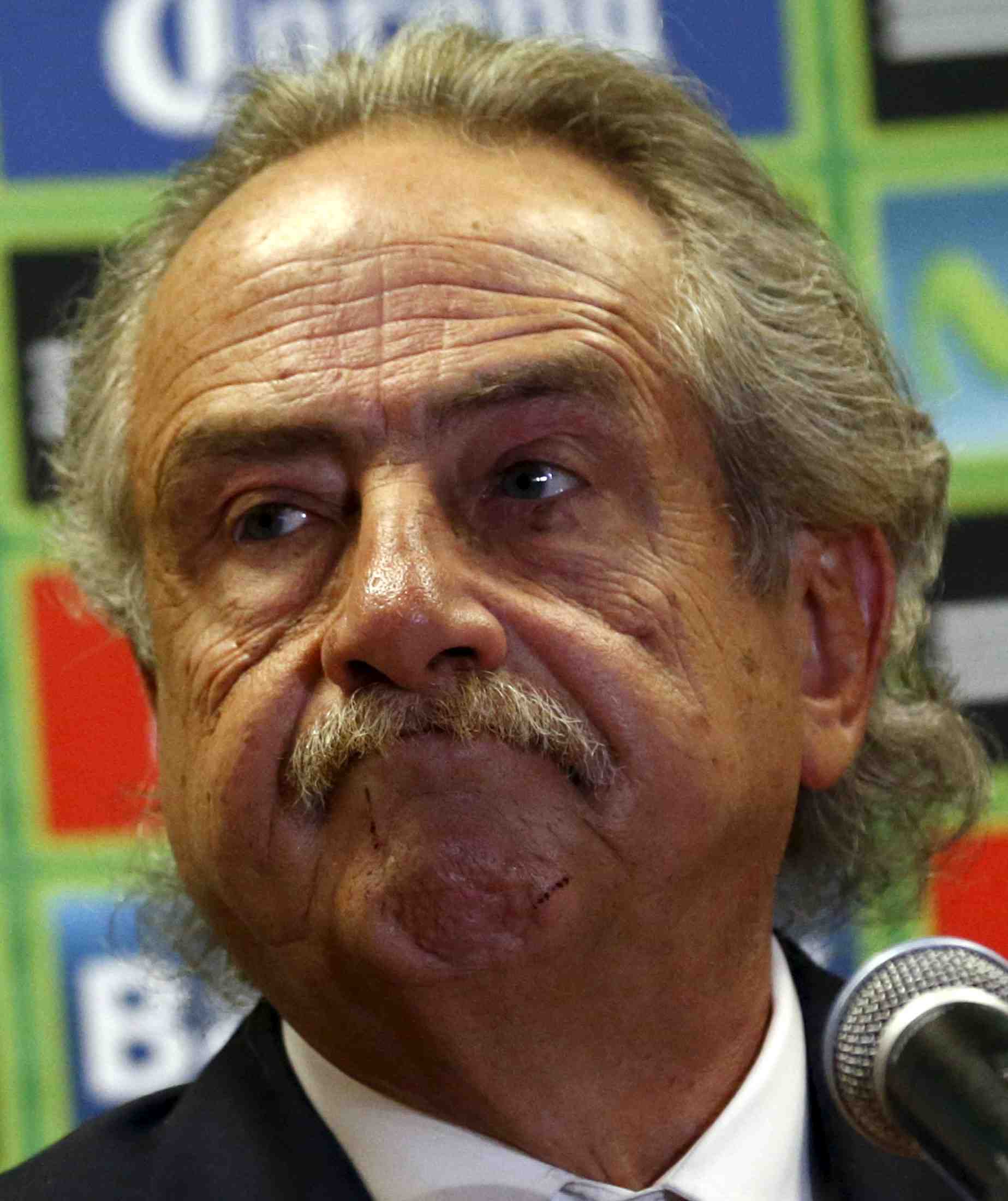 Herrera limoge pour avoir frappe un journaliste
