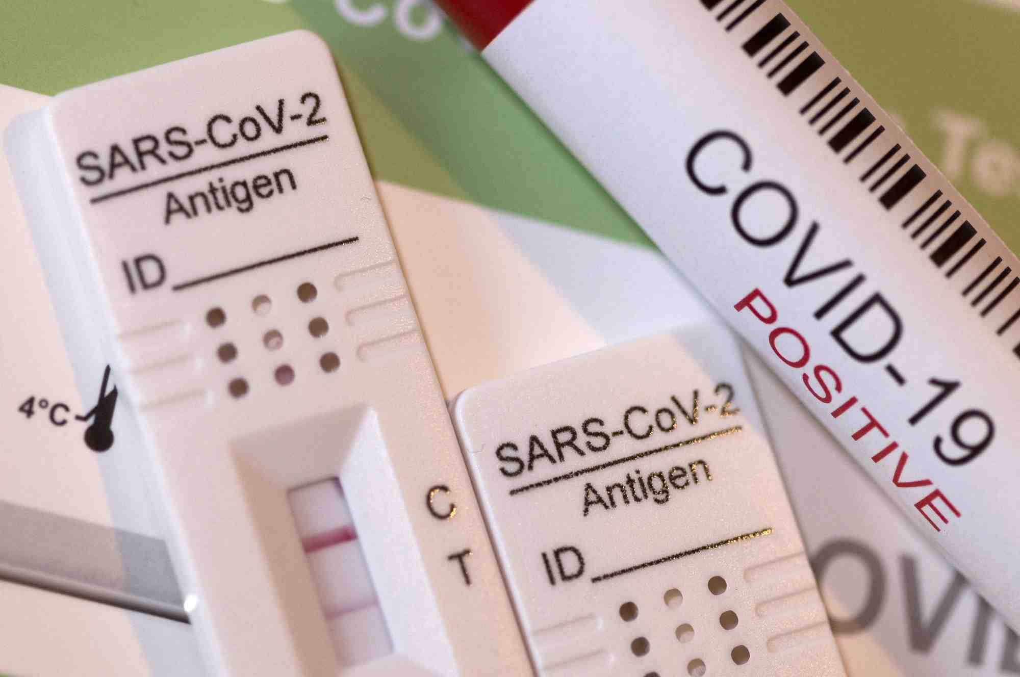 France: en echec a l'assemblee, le gouvernement entend defendre son projet de loi sanitaire