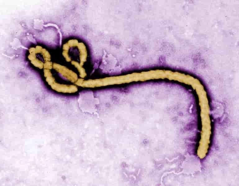 Un cas de fievre ebola diagnostique en ecosse