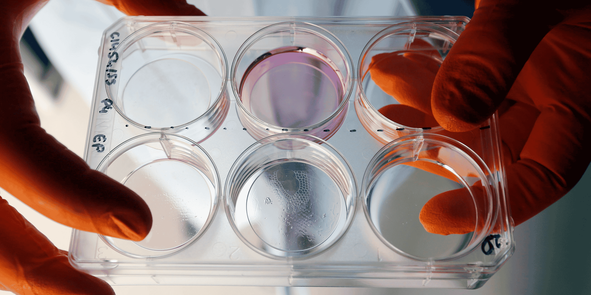 Un prix d'inventeur europeen 2019 pour un chercheur de l'inserm