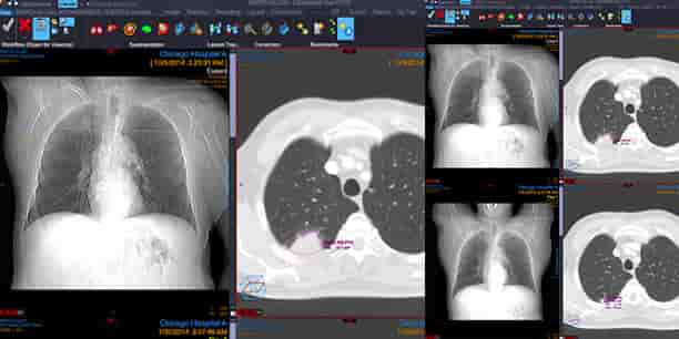Imagerie Carestream
