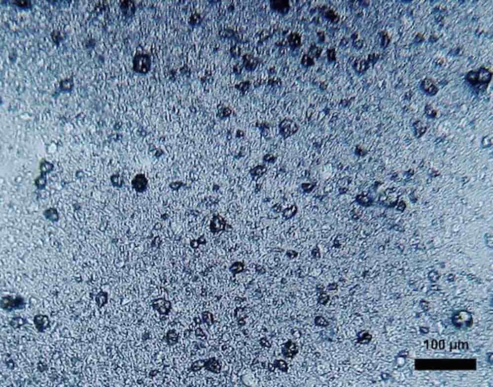 Parmi ces microplastiques se trouvent des microbilles présentes dans certains cosmétiques et des dentifrices, mais surtout des minuscules fragments de moins de cinq millimètres.