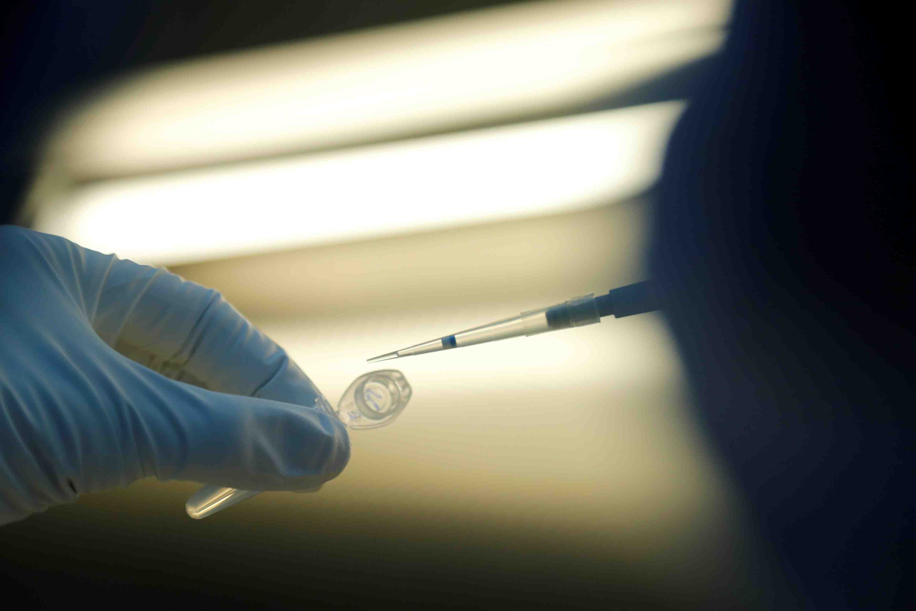 Les scientifiques inquiets de l'autorisation d'un vaccin russe