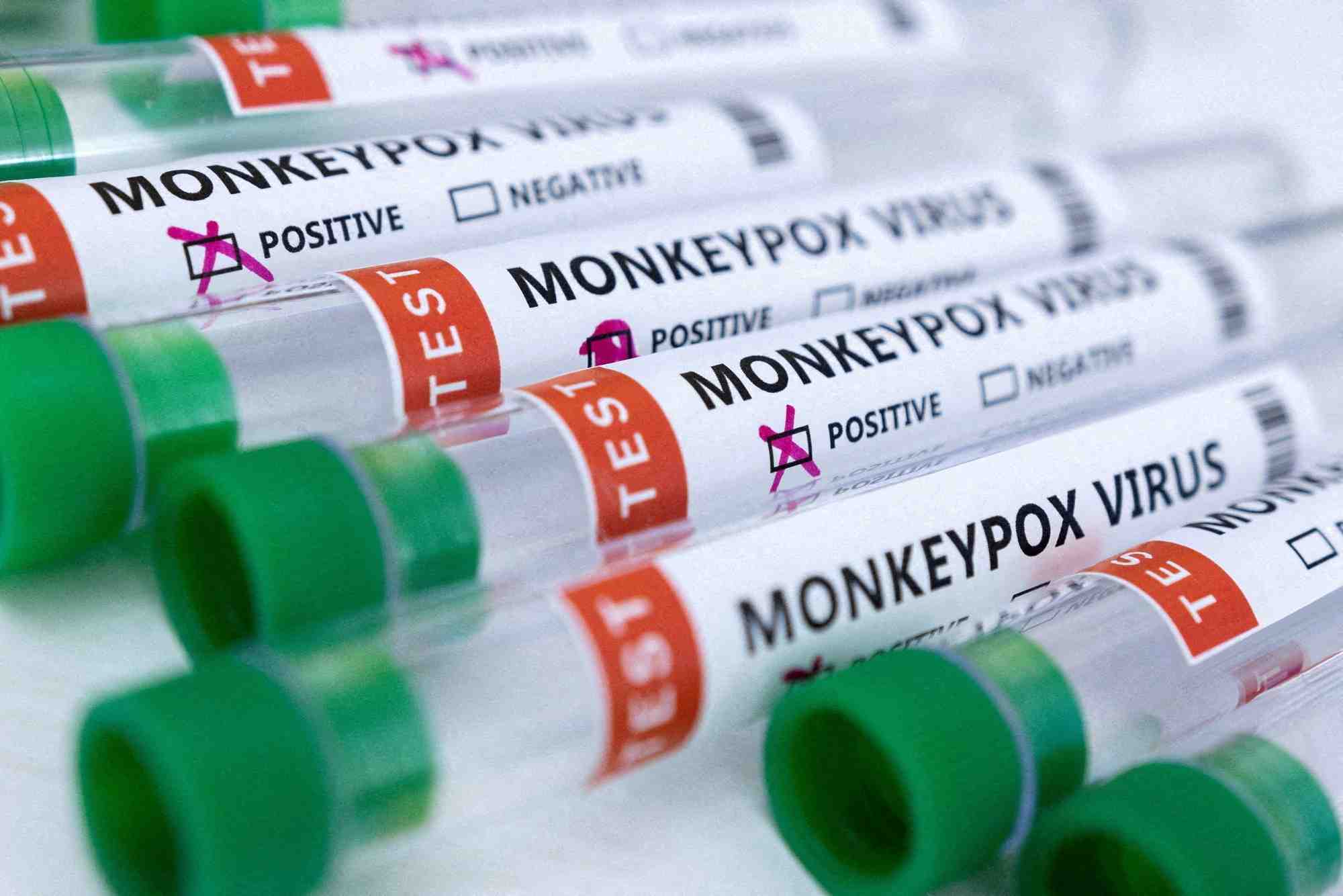 Variole du singe: l'ue obtient des doses supplementaires du vaccin de bavarian nordic