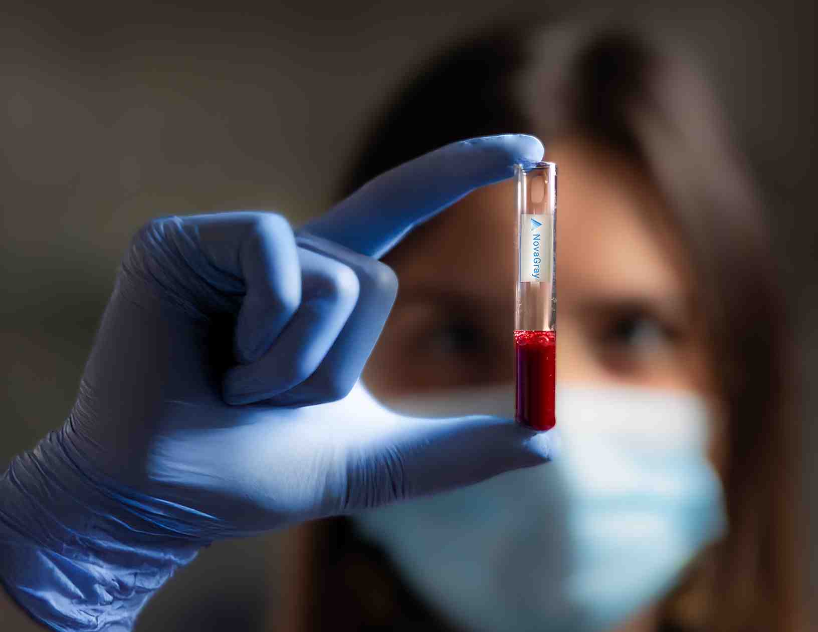 « Plus de 400 patients ont déjà bénéficié du test depuis mars 2025 »