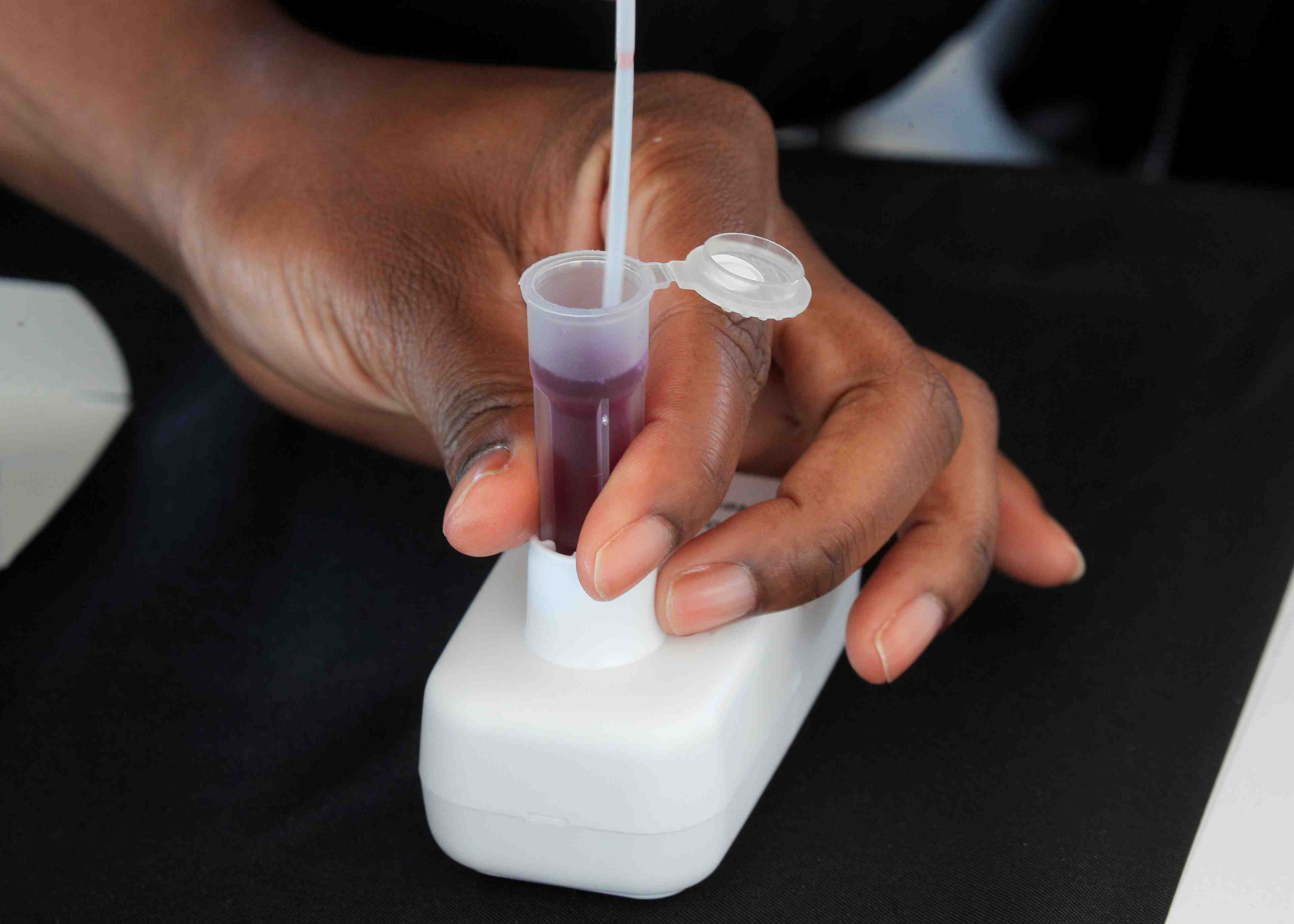 Coronavirus: un premier cas du variant omicron identifie a la reunion
