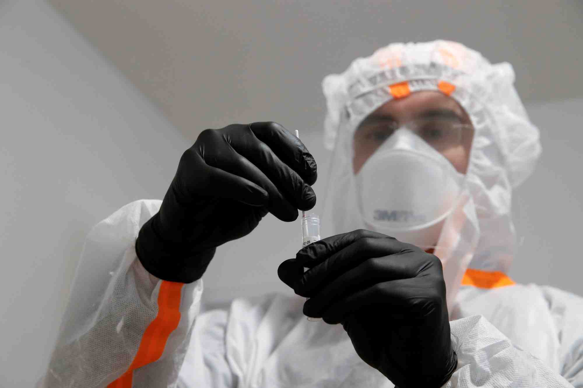 Coronavirus: des biologistes s'interrogent sur la strategie de depistage