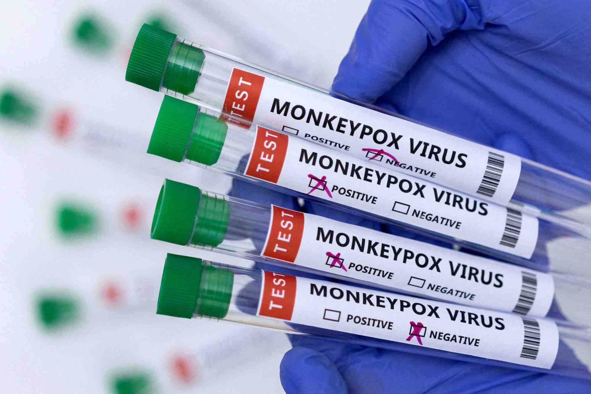 L'ue va acheter 110.000 vaccins contre la variole du singe a bavarian nordic