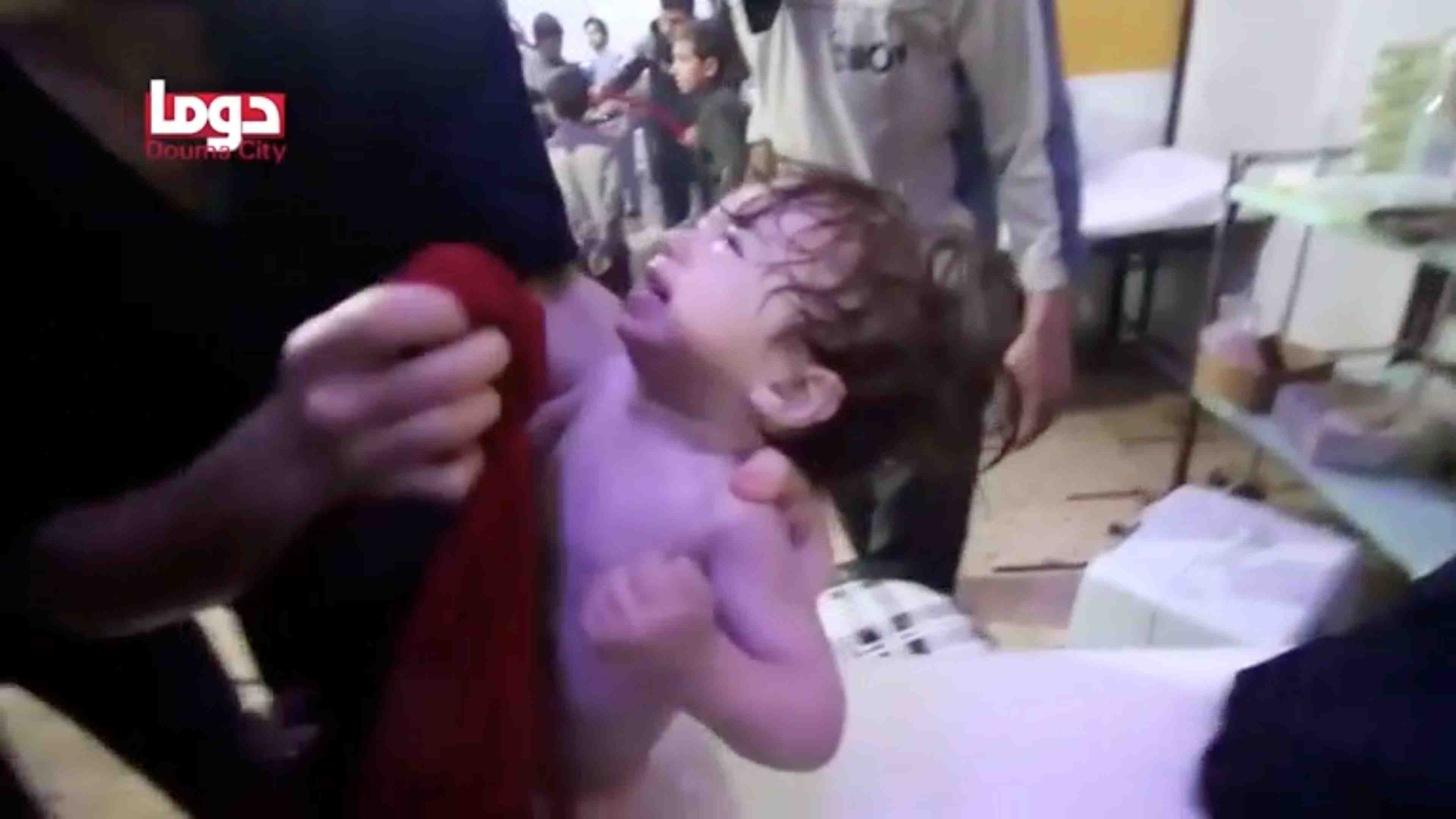 Douma: 500 patients ont ete exposes a des agents toxiques, dit l'oms