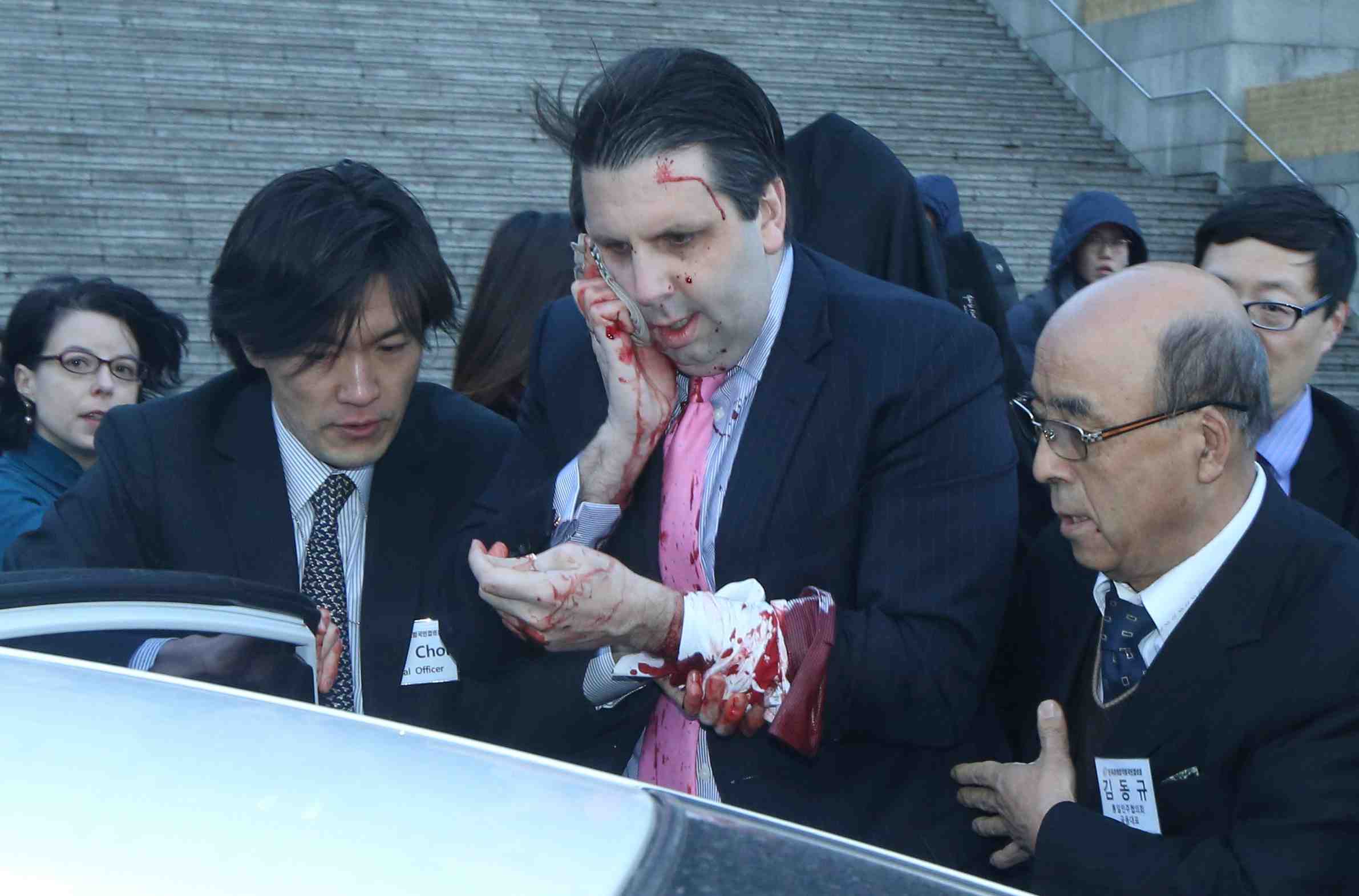 L'ambassadeur des etats-unis en coree du sud blesse dans une agression au couteau a seoul