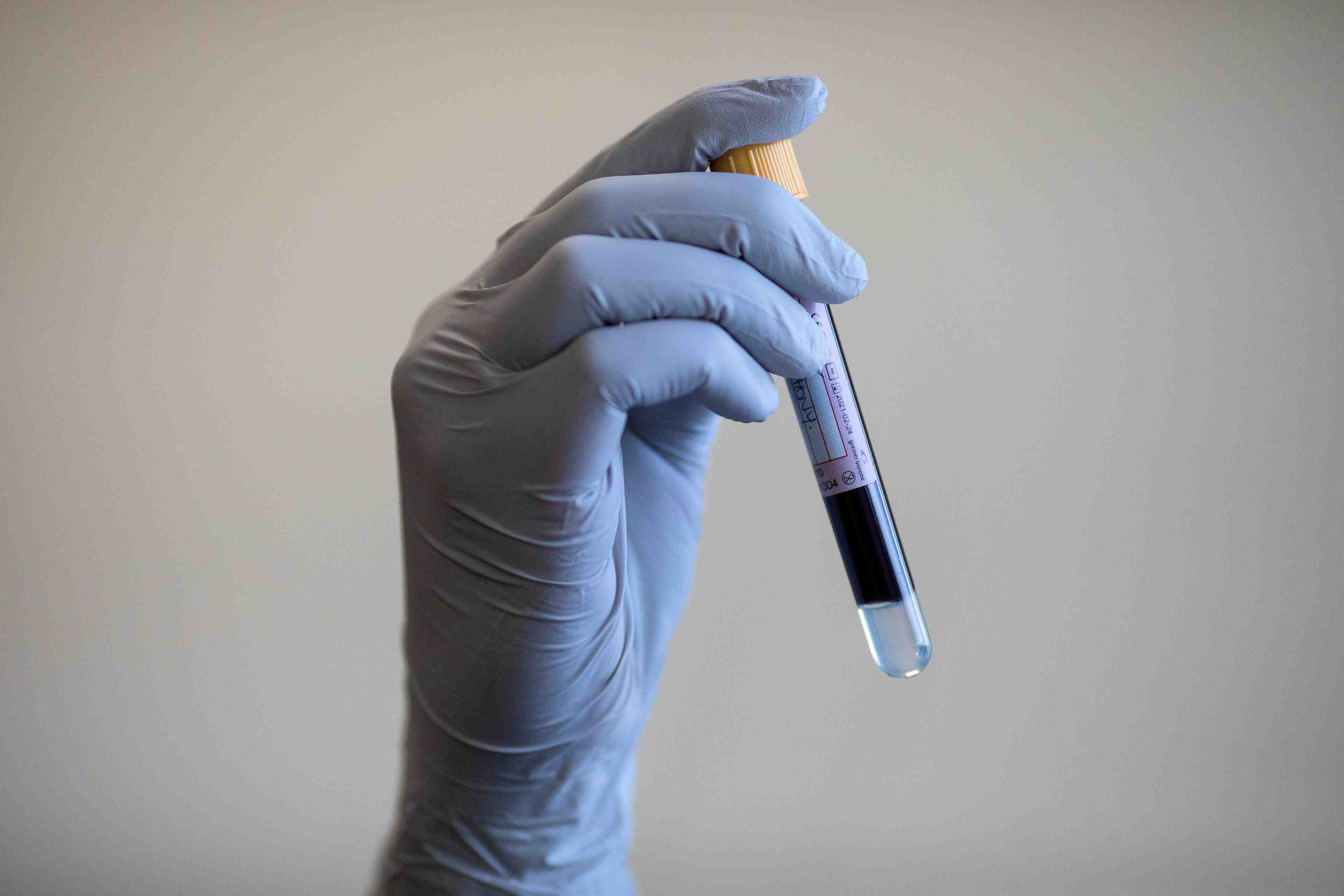 Coronavirus: le royaume-uni recense 713 nouveaux cas de contamination