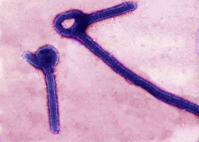 La fièvre Ebola continue de se propager en Sierra Leone
