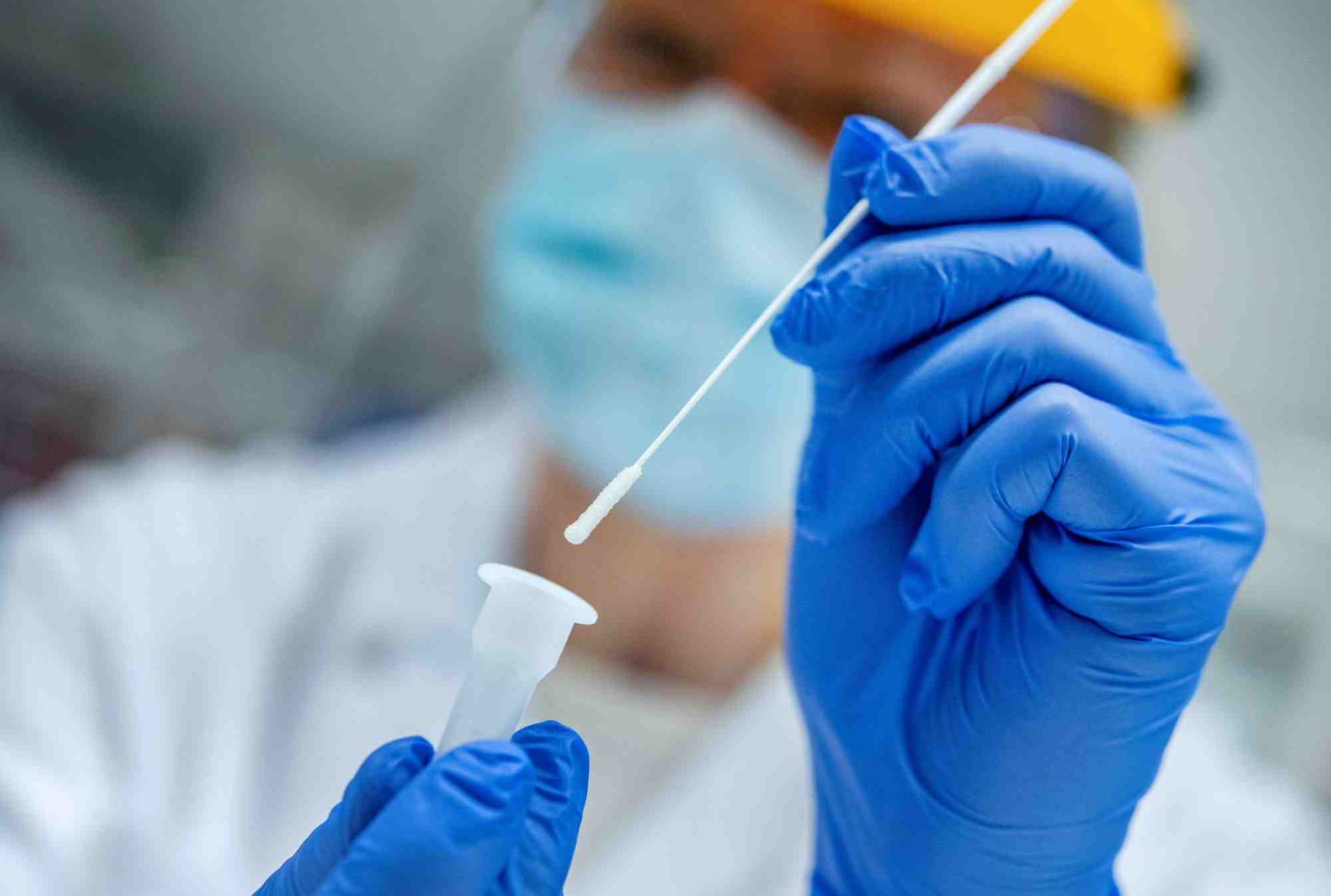 Record de patients hospitalises pour le covid-19 en suede