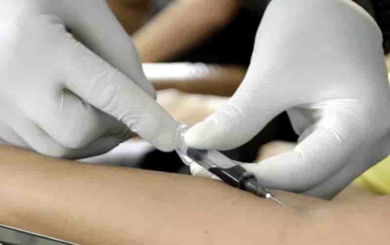 Premier cas autochtone de dengue dans le Var