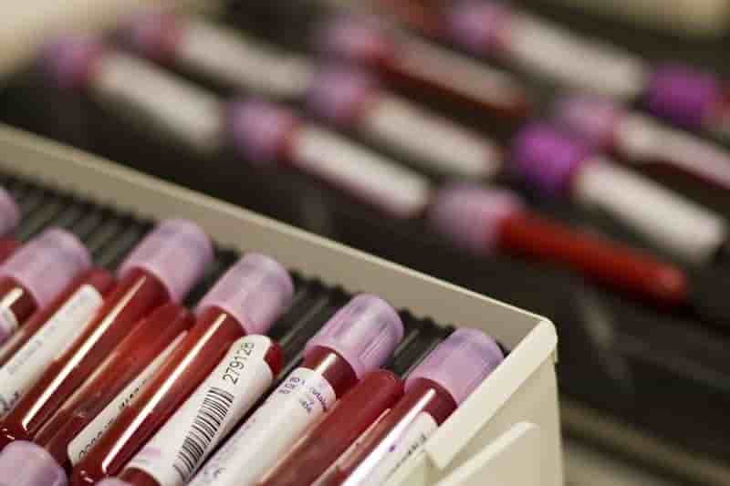 Espoir d'un test sanguin de dépistage précoce d'Alzheimer
