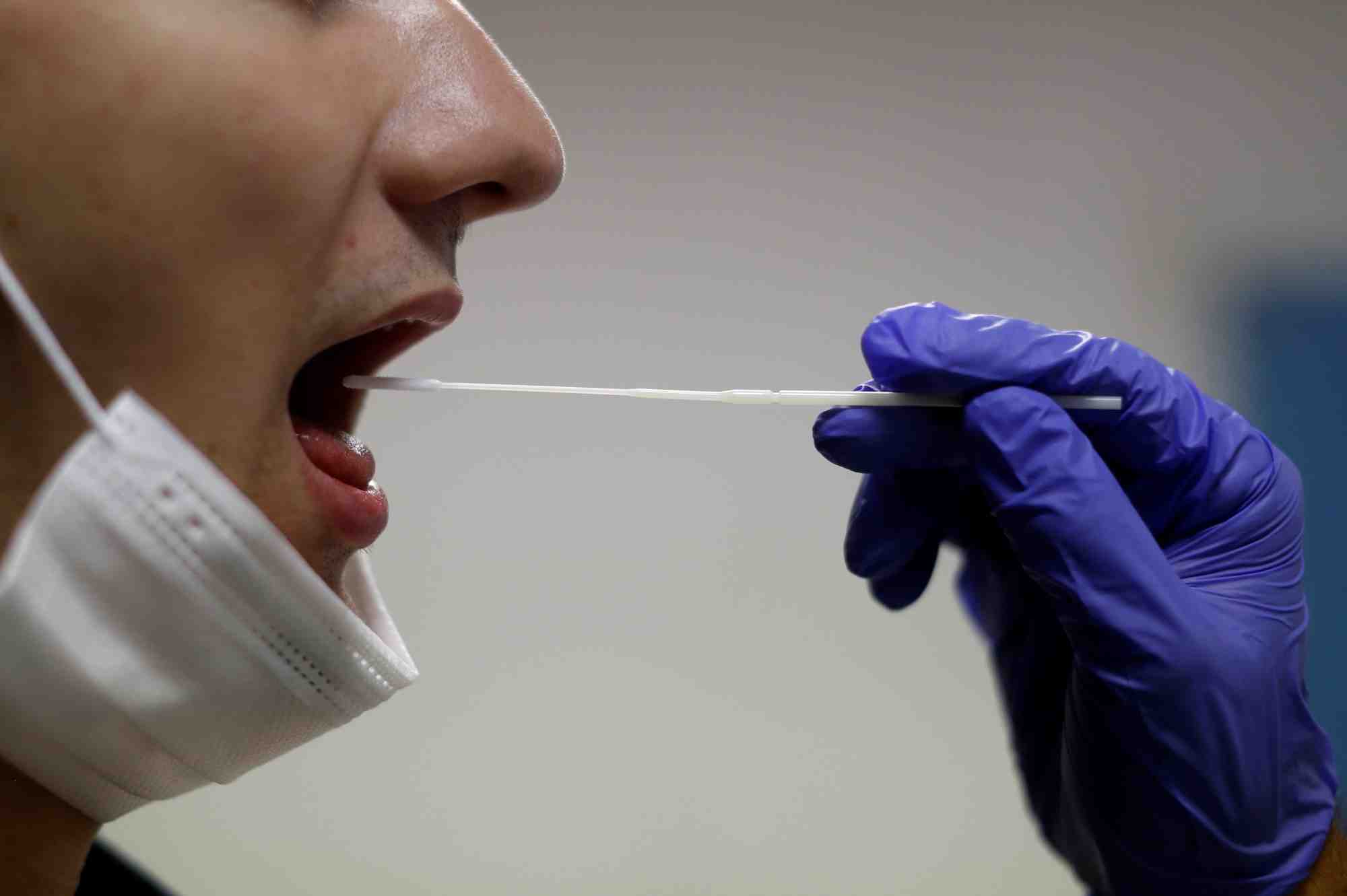 Coronavirus: l'oms promet 120 millions de tests a 5 dollars pour les pays pauvres