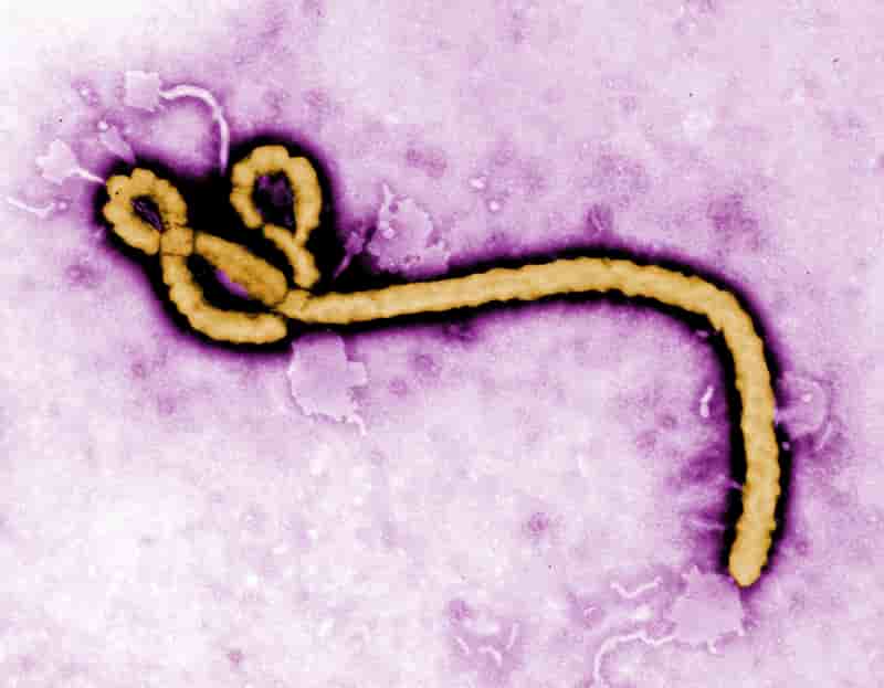 L'OMS priée d'autoriser un traitement expérimental sur Ebola