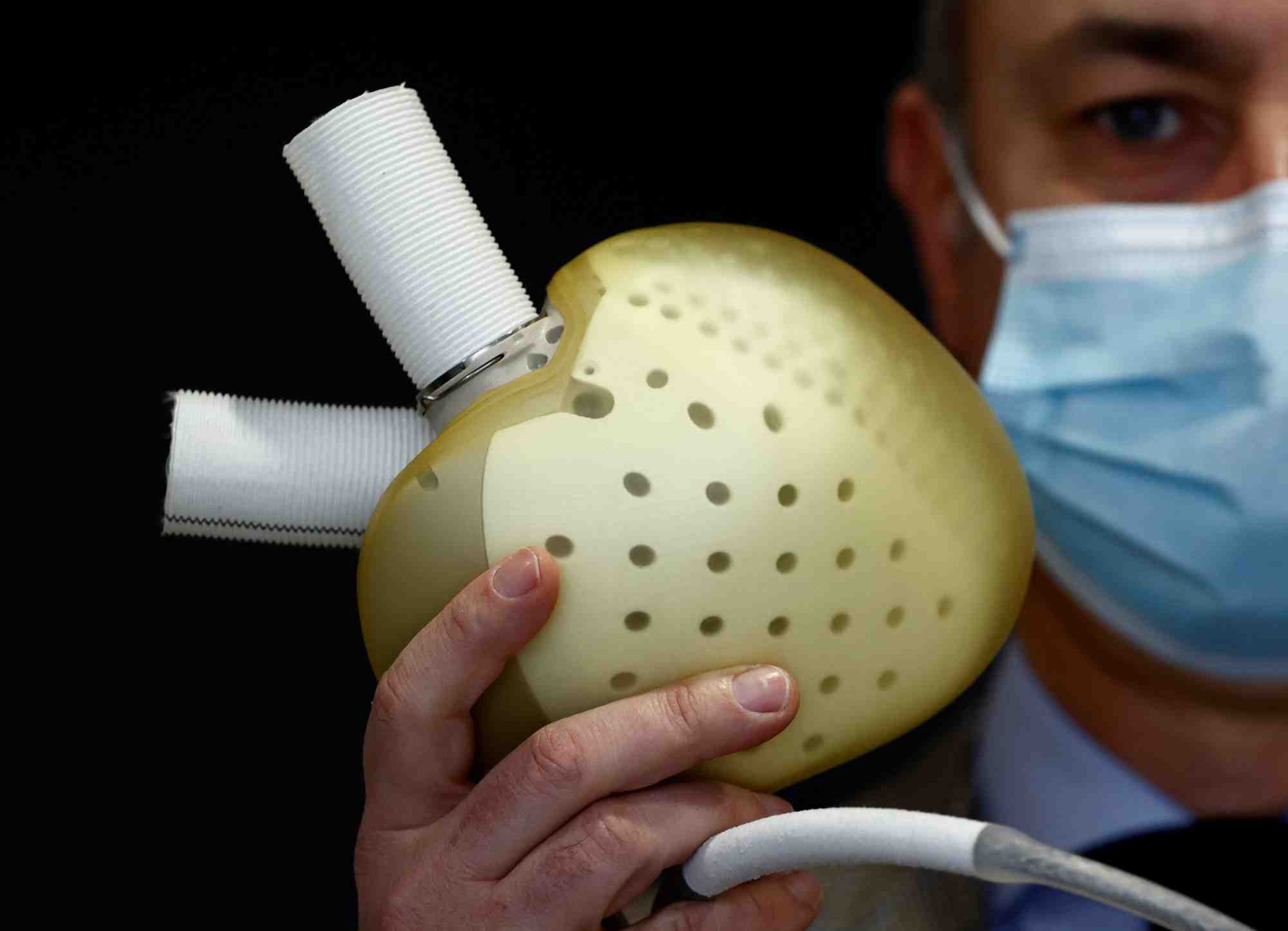 Coeur artificiel produit par le fabricant francais Carmat.