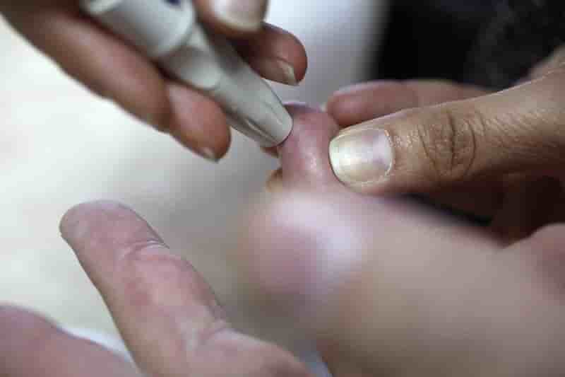 Essais cliniques pour un dispositif de delivrance d’insuline