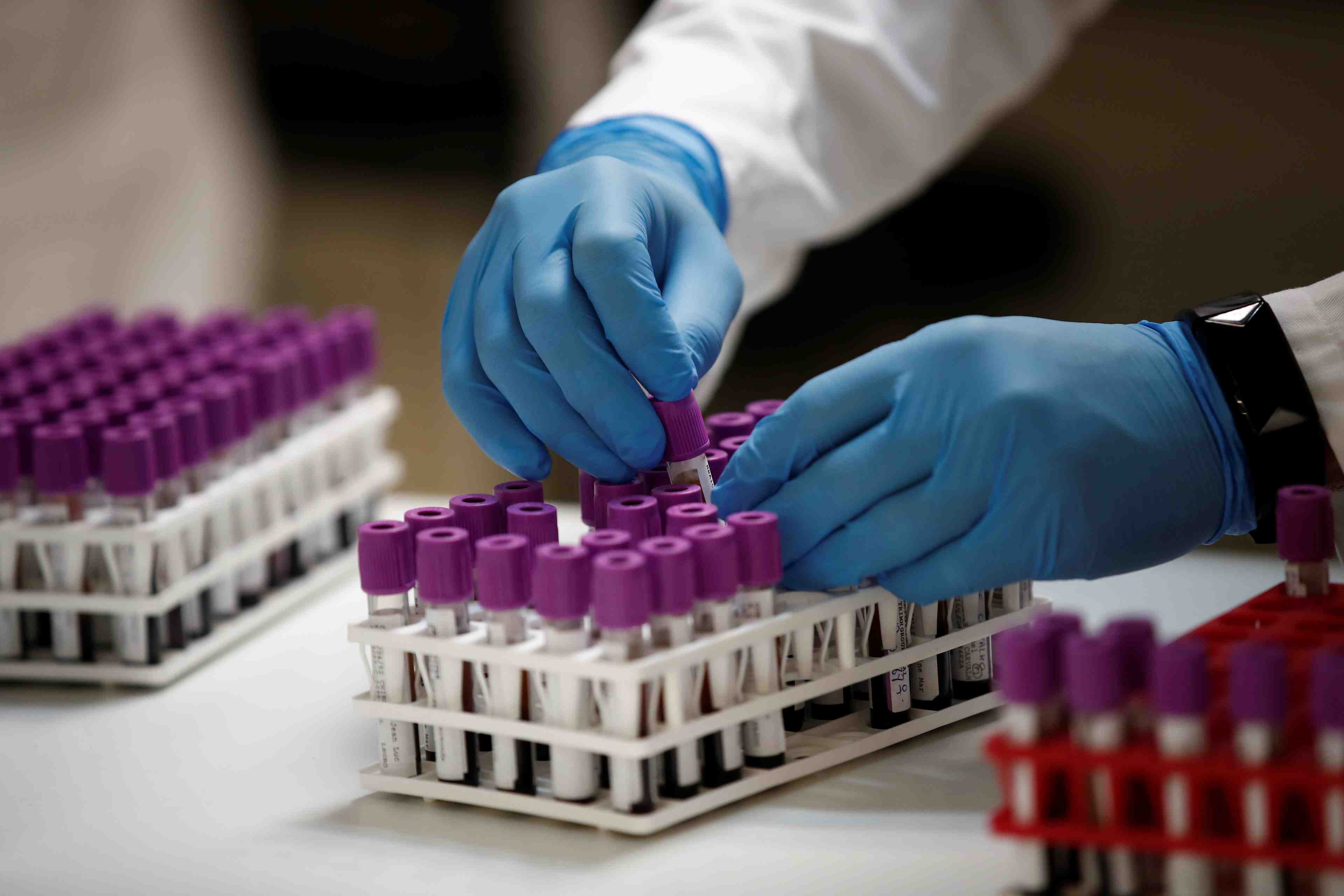 Le coronavirus a fait 28.367 morts (+35)