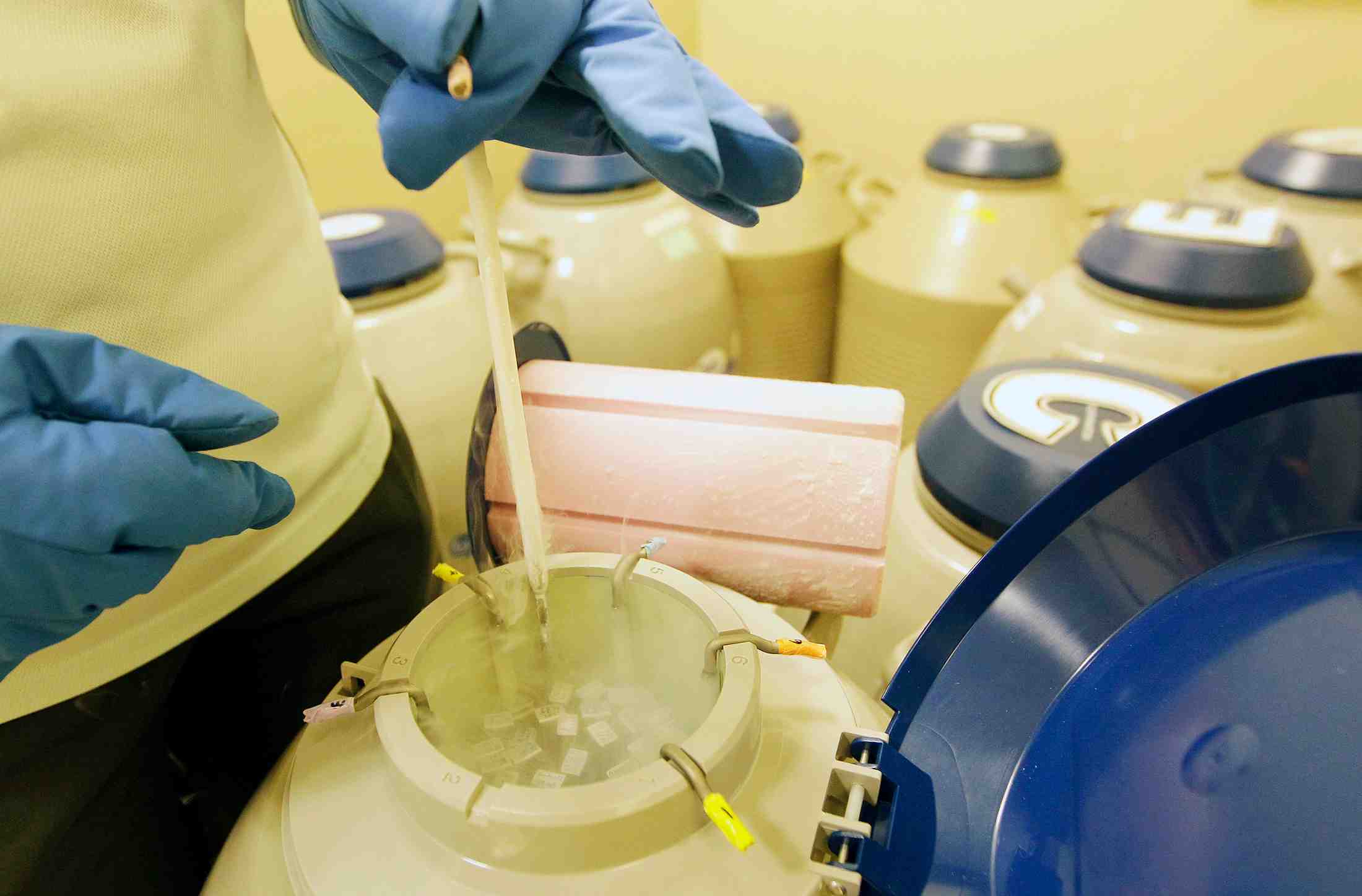 Le risque de penurie de gametes, l'inconnue de la loi bioethique