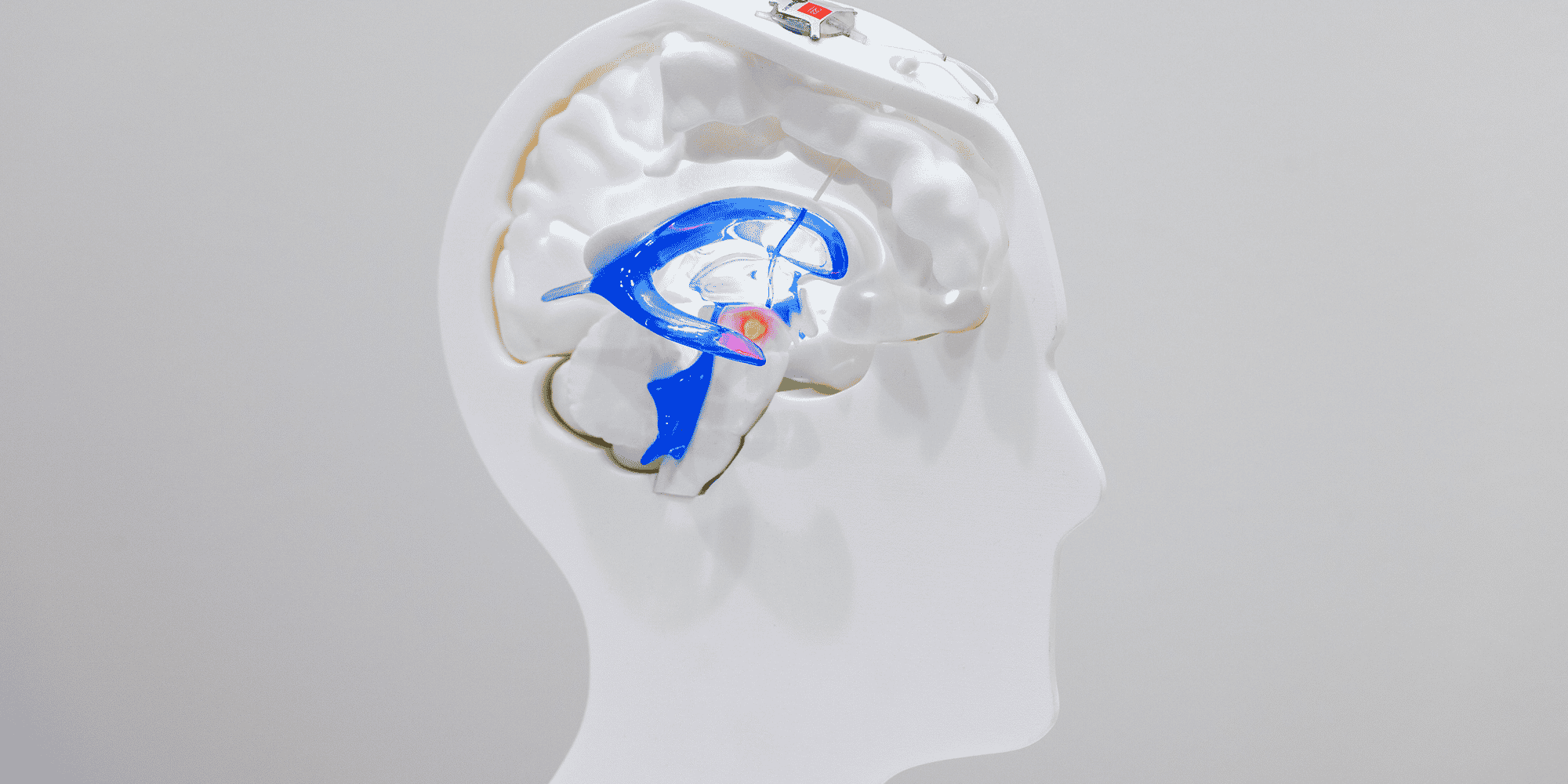 Depuis sa création, l'institut de recherche biomédicale grenoblois Clinatec a mené plus de 35 projets de recherche majeurs, dont 25 ont bénéficié du soutien du Fonds de dotation Clinatec.